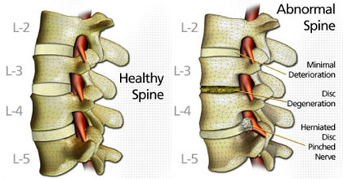 http://www.yuchamedicalchiro.com/sys/blog/1010.jpg